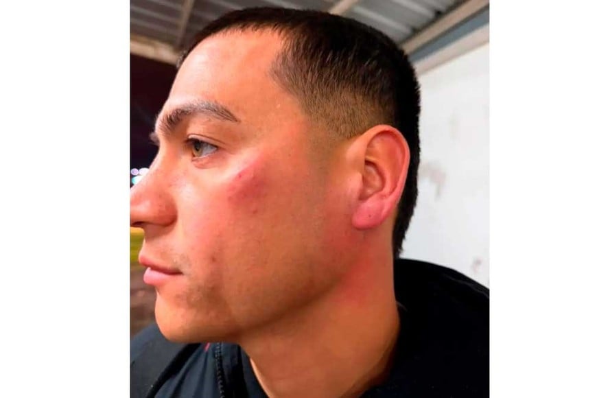 Alan Sosa, capitán del equipo parananese con signos de un golpe en el rostro. Crédito:  Gabriel Obelard