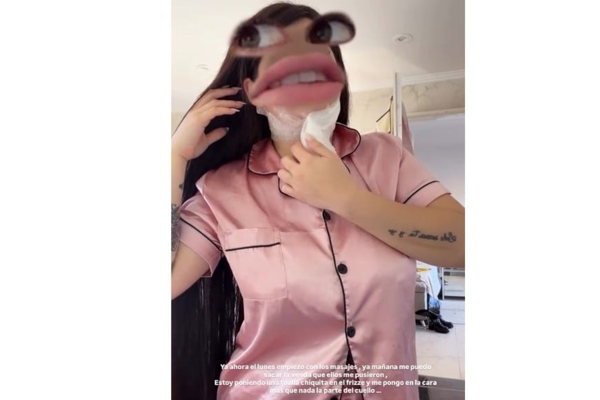 La influencer compartió imágenes de su recuperación en redes sociales.