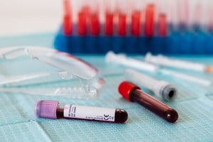 Una enfermedad de la sangre que suele avanzar lentamente