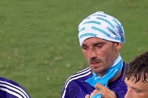 Paño frío para el francés.
