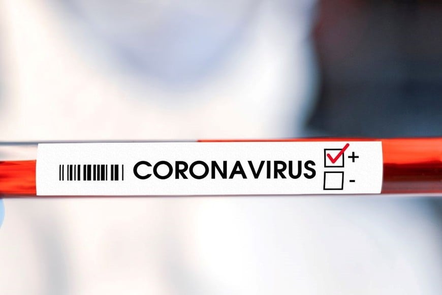 Los casos fueron identificados a partir del análisis de muestras obtenidas durante varias semanas epidemiológicas.