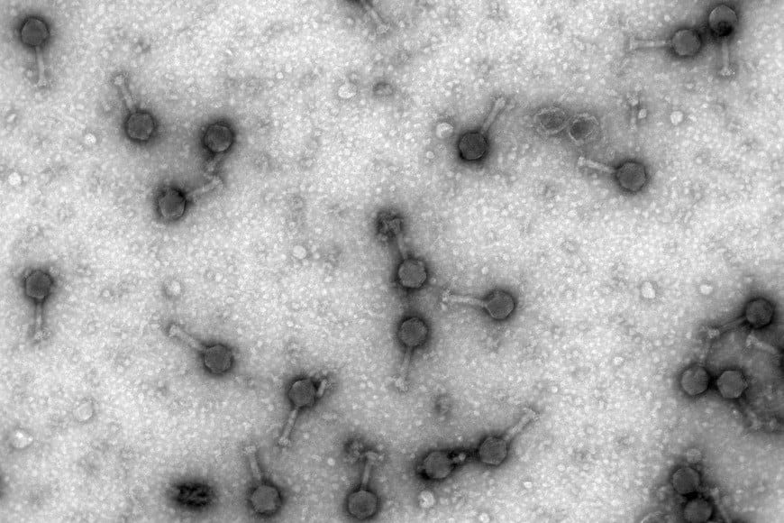 Micrografía electrónica de fagos, obtenidas en la Universidad de Valencia por el equipo de la doctora Pilar Domingo Calap. Foto: Gentileza Agencia Cyta