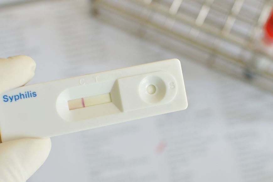 infecciones de transmisión sexual