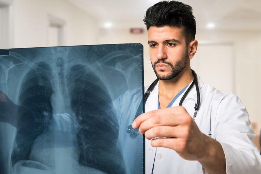 Un hallazgo inesperado en una radiografía de tórax