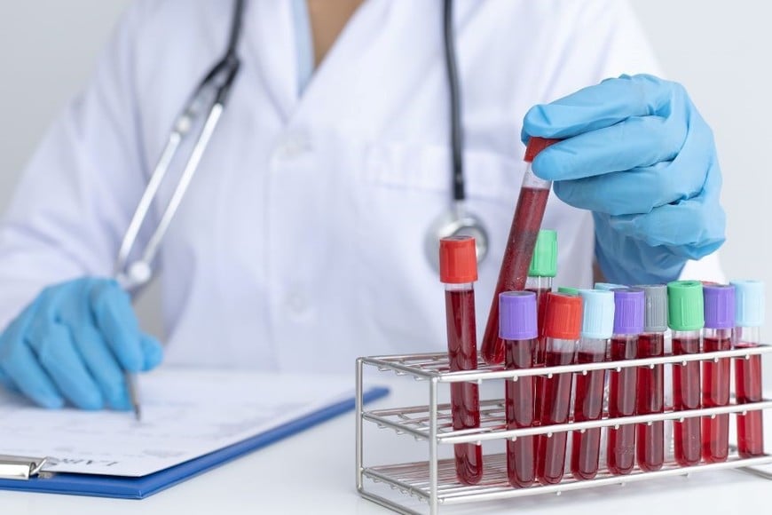 La sífilis es una infección causada por la bacteria Treponema pallidum.
