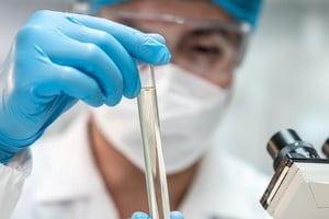 Los estudios científicos buscan ampliar el conocimiento sobre la infección detectada en Francia.