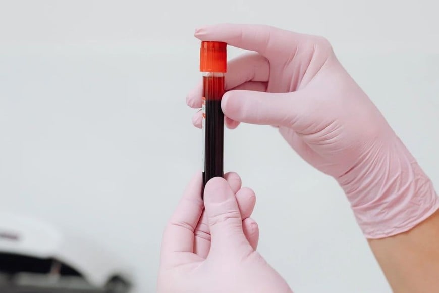 La anemia persistente puede requerir estudios para identificar su causa.