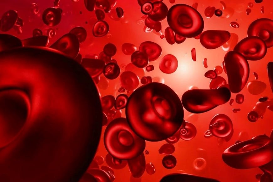 1. El diagnóstico puede incluir análisis de sangre y un estudio de médula ósea.