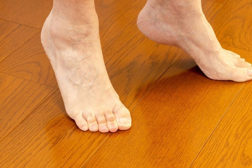 La fascitis plantar puede causar dolor en el talón al dar los primeros pasos del día.