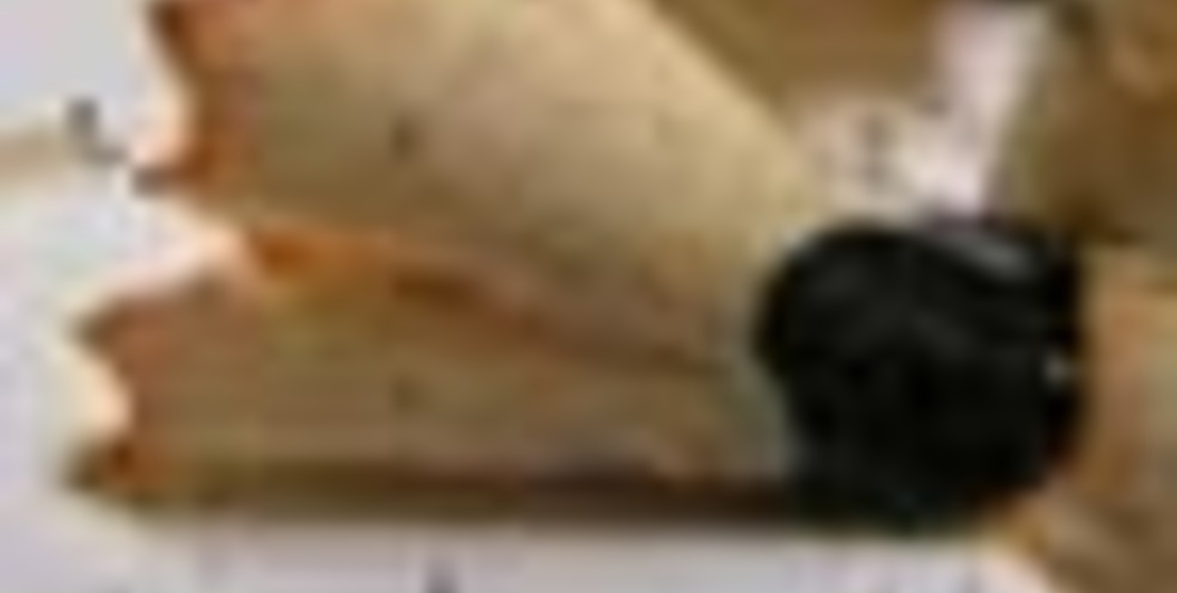 Tuvo la punta de un lápiz en el paladar por 20 años