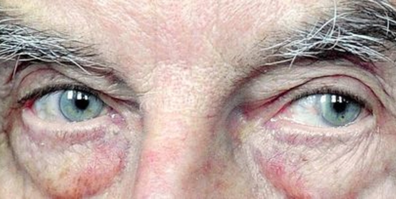 Cadena perpetua e internación psiquiátrica para Josef Fritzl