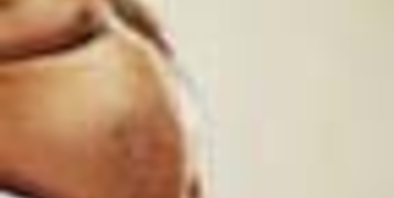 El más gordo del mundo bajó 200 kilos