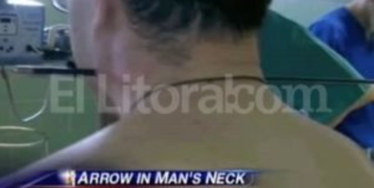Un flechazo le atravezó el cuello y sobrevivió para contarlo