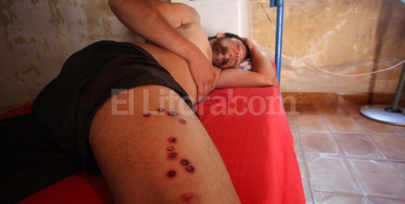 Grave denuncia por brutalidad policial