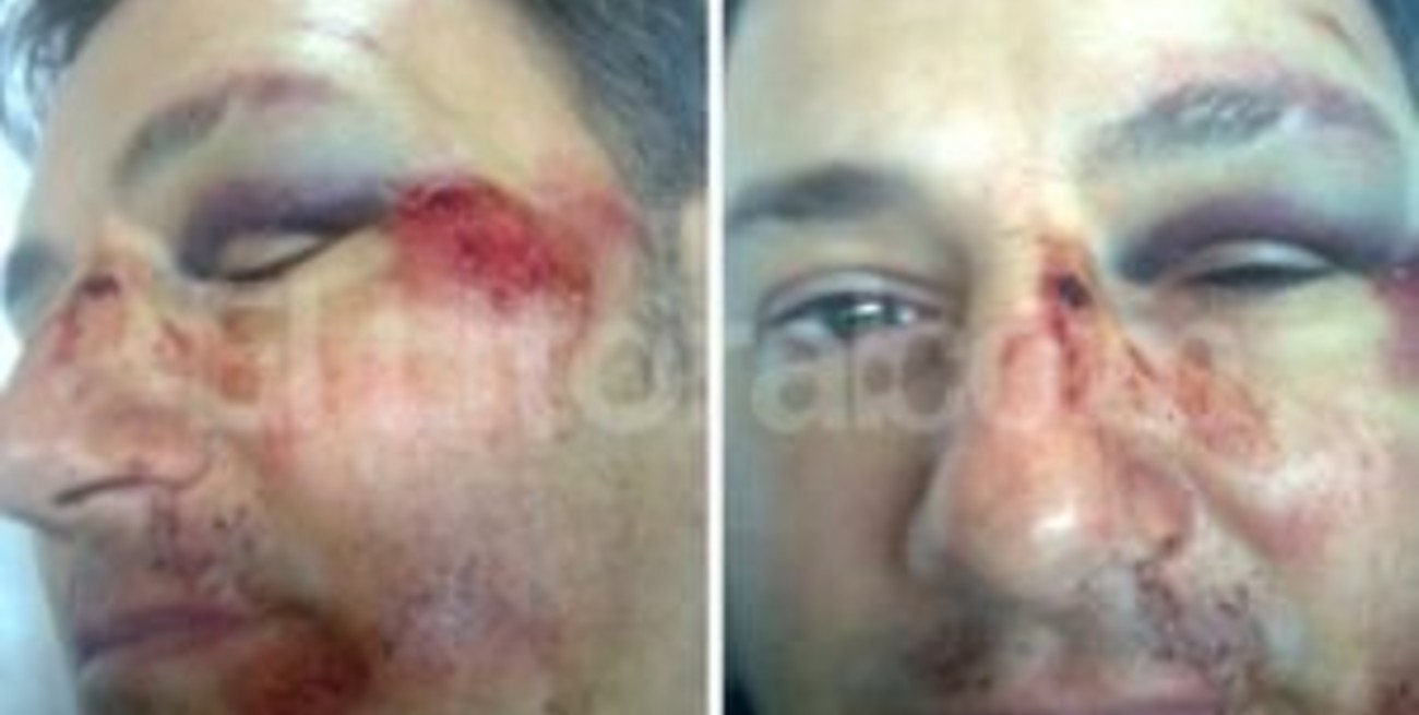 Detienen a la mujer que agredió a un director de escuela en Pergamino