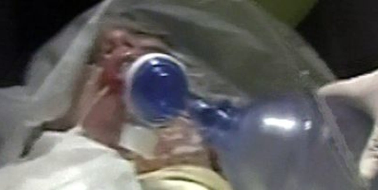 La esposa del baterista de Callejeros está grave y tiene el 50 % del cuerpo quemado