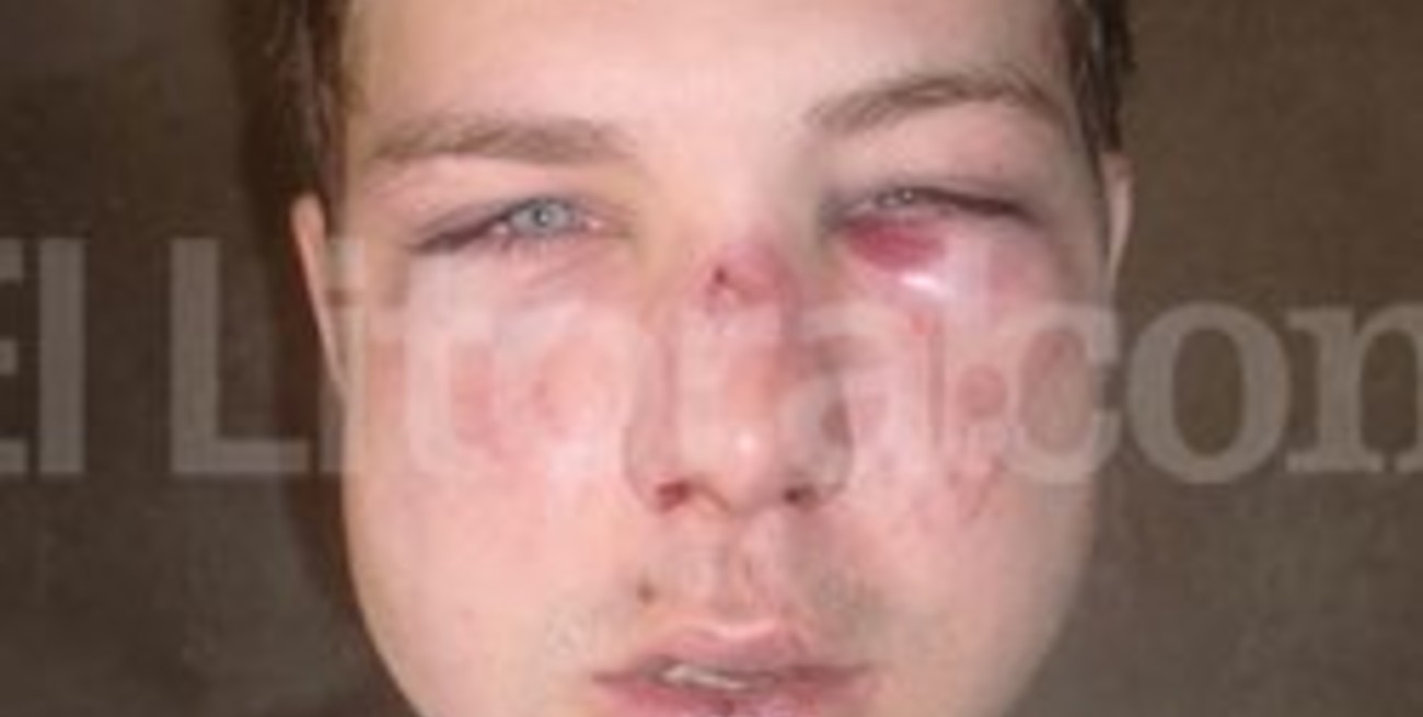 "Sólo quise defender a mi novia"