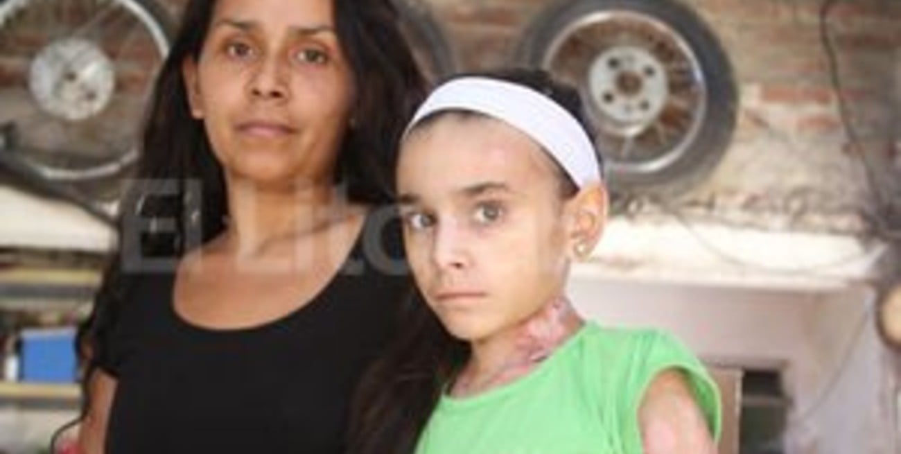 Sofía, una niña con piel de cristal que necesita ayuda 