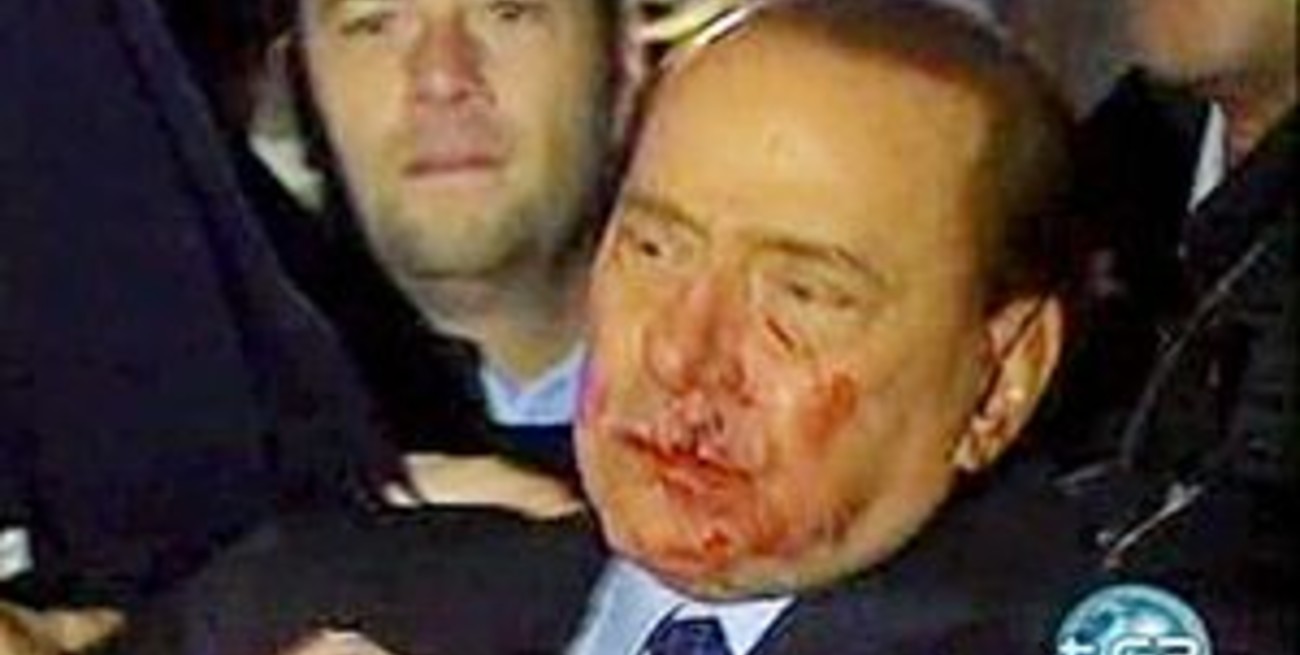 Un hombre golpeó a Berlusconi y lo mandó al hospital