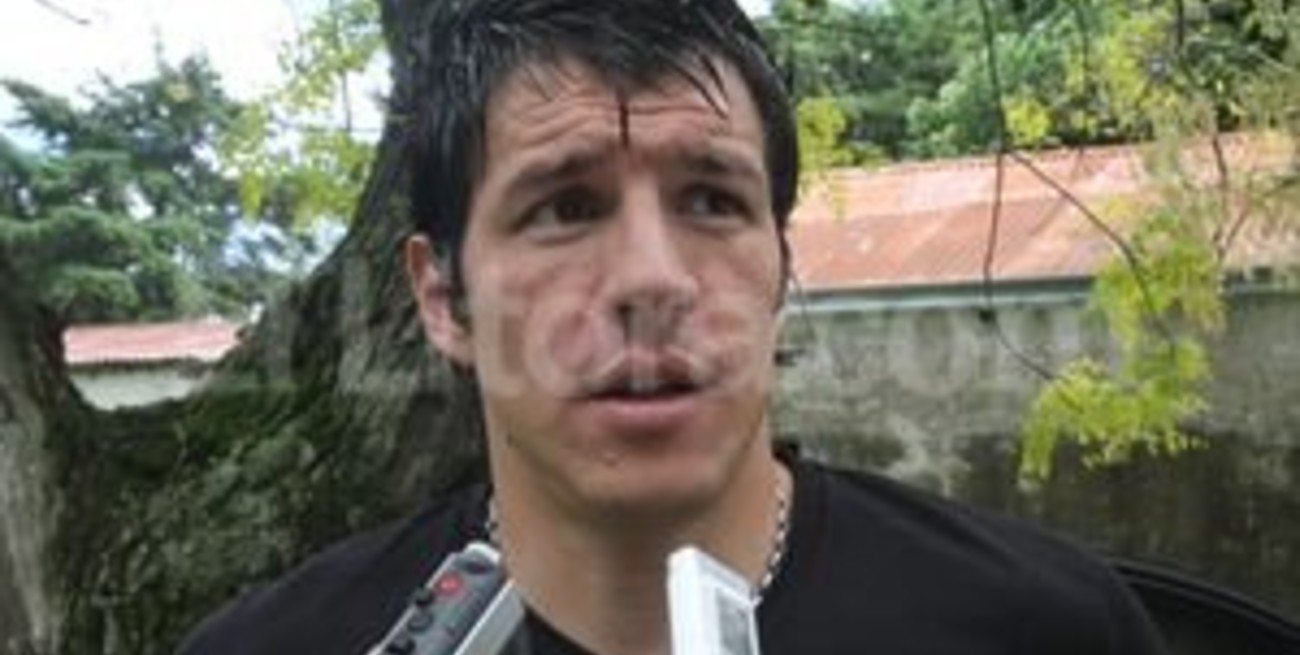 Grave lesión sufrió el ex arquero de Unión Enrique Bologna