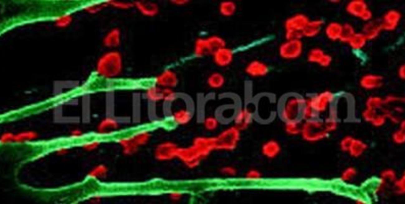 Nicaragua espera ?inminente? llegada de virus chikungunya 