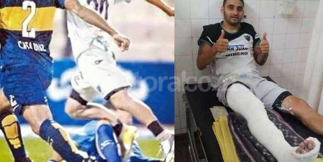 Operan a Bueno tras sufrir una fractura de tibia y peroné