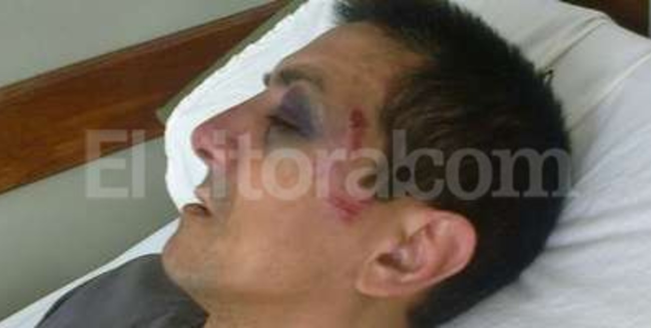 Un hombre denuncia una salvaje agresión policial