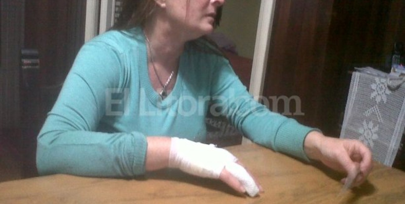 Tres heridos en intentos de robo