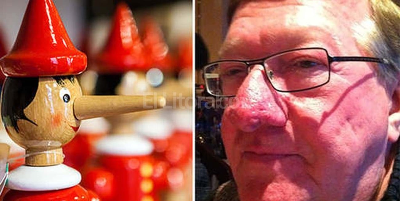 Un holandés, campeón mundial de narigones