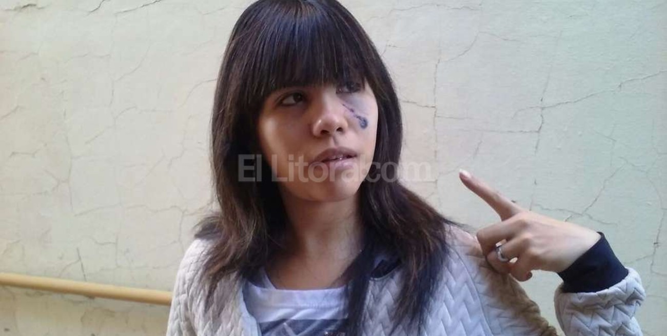 Recibió un tiro en el rostro al defenderse de un asalto