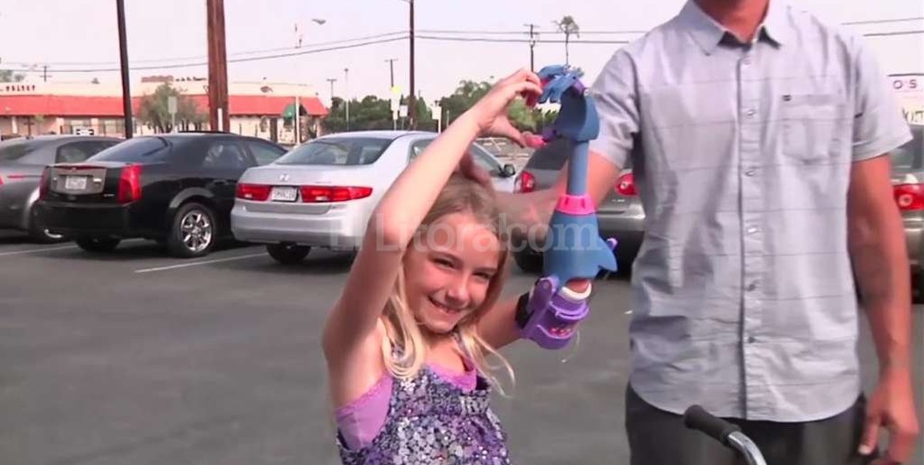 Una prótesis para una niña hecha con una impresora 3D