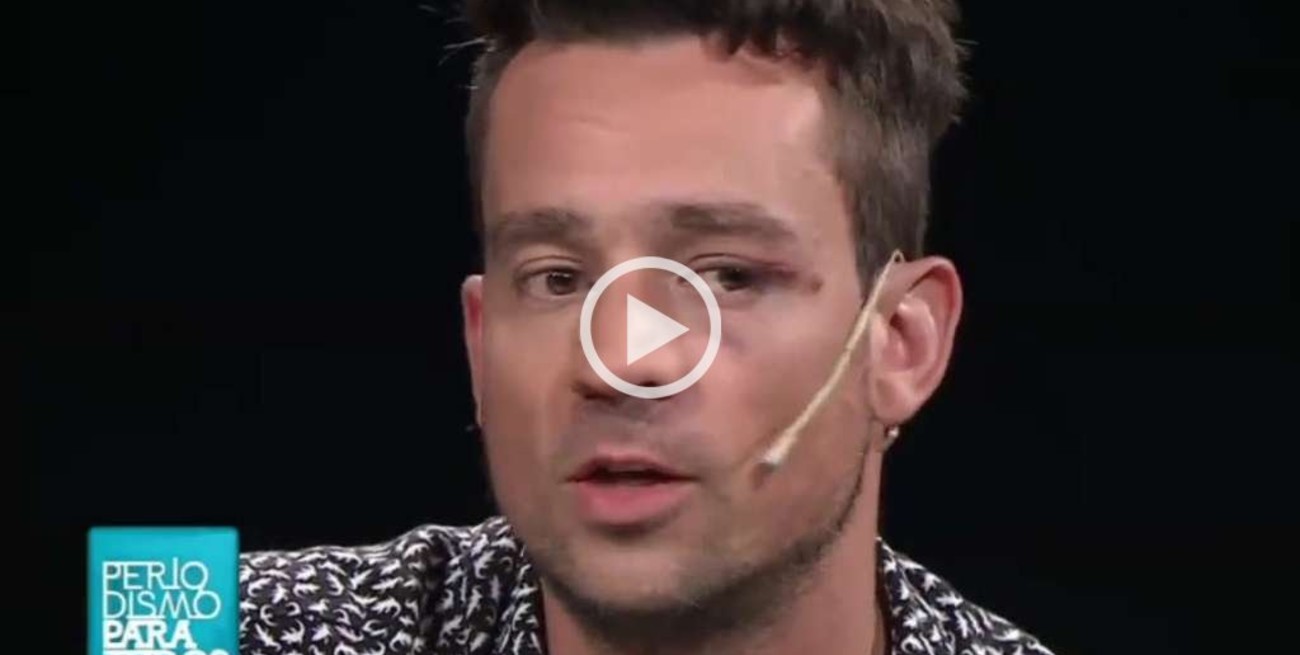 Chano habló con Lanata: "Soy adicto, tengo una enfermedad crónica"