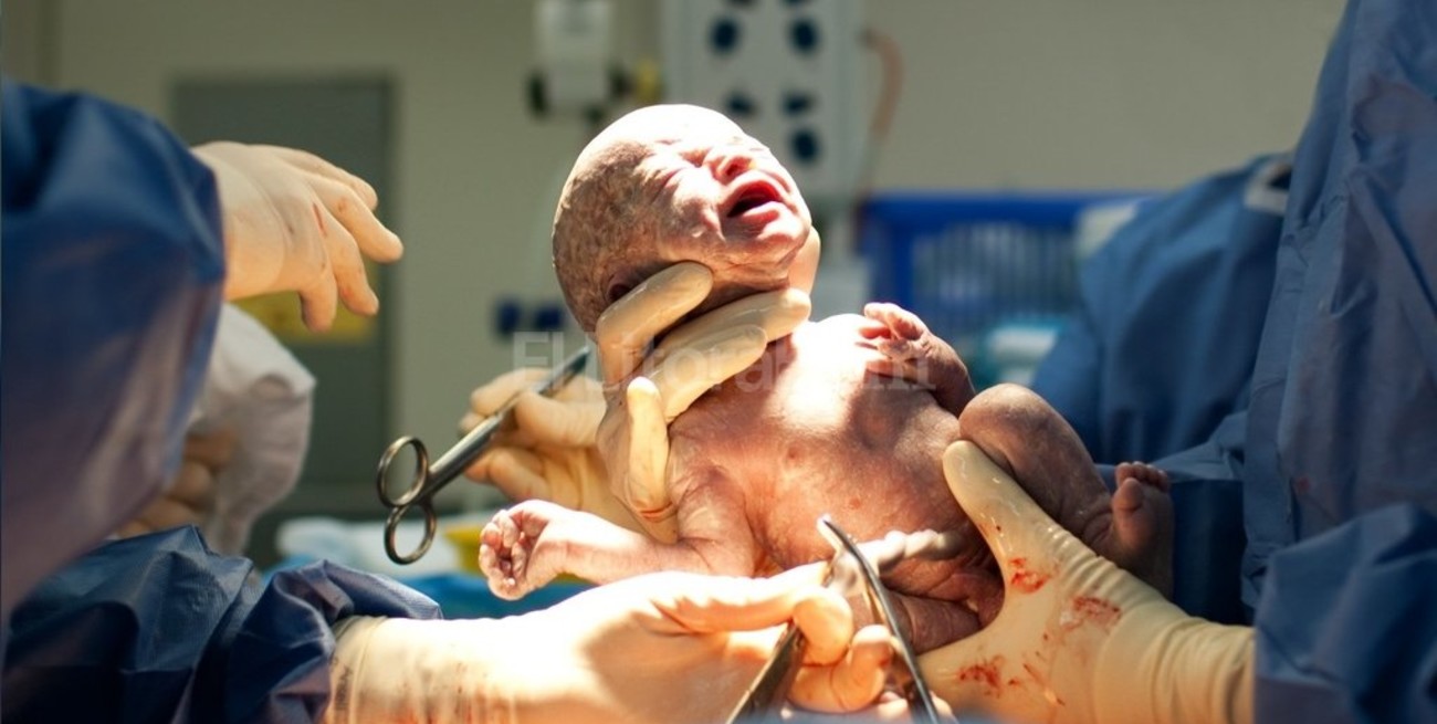 En el país cada vez se hacen  más cesáreas innecesarias