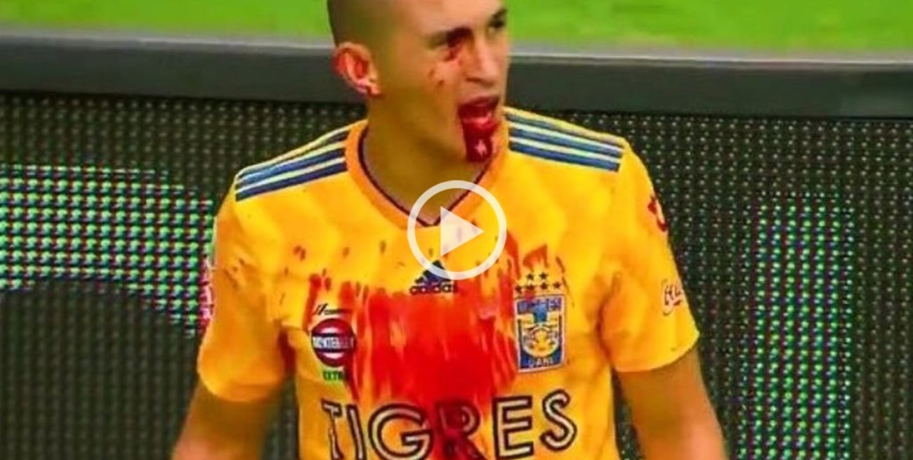 Triverio le dejó toda la cara ensangrentada a un rival 