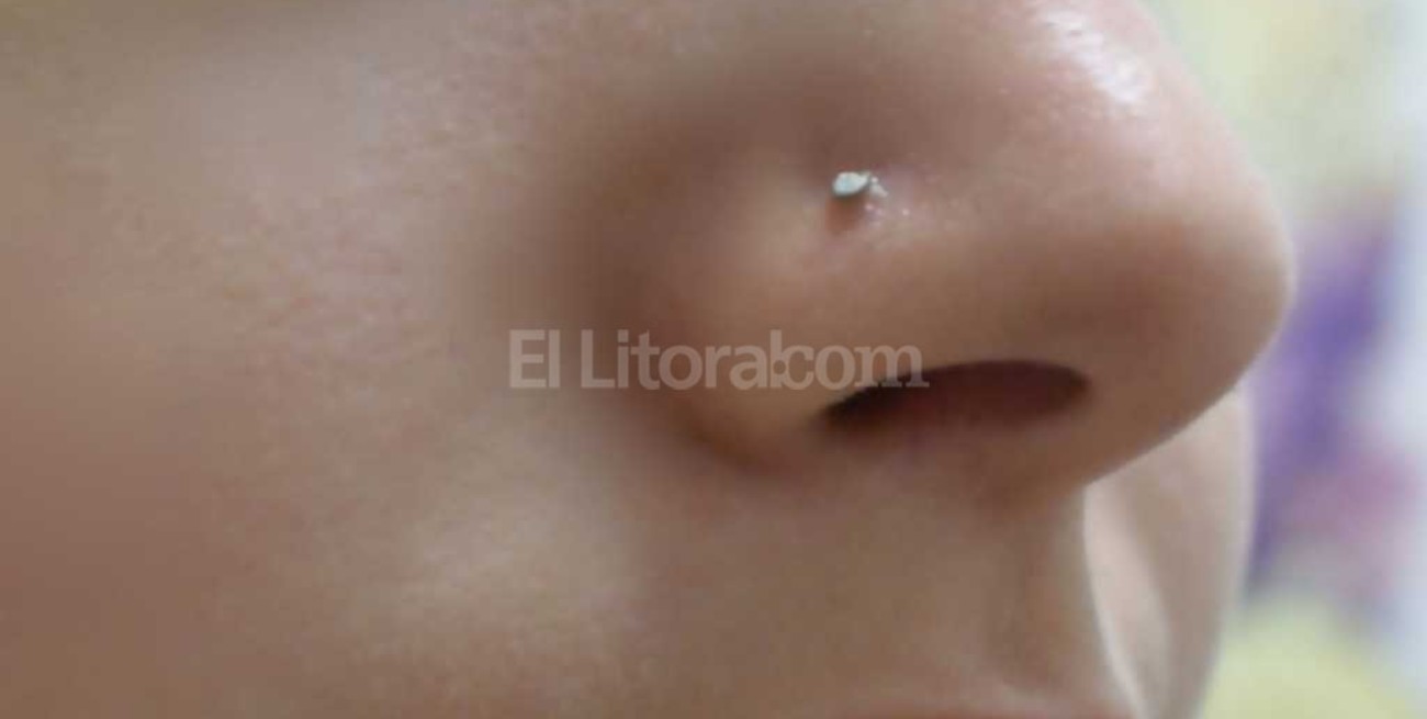 Otra grave infección cuya causa puede haber sido un piercing