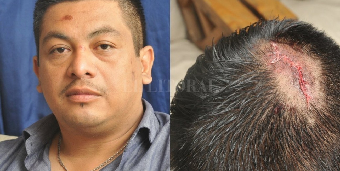 Atropelló a un policía, lo llevó en el capó varias cuadras y escapó