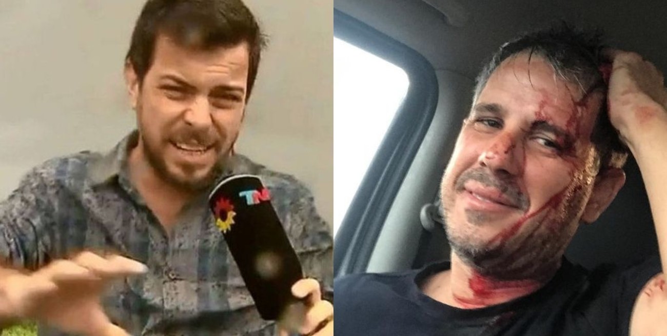 José Bianco cubrió en vivo una tormenta y su camarógrafo resultó herido