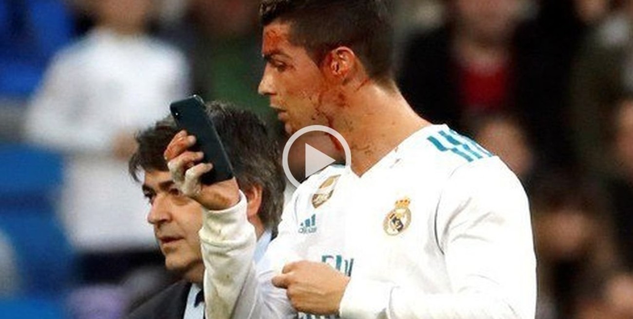 Cristiano Ronaldo sufrió un corte en la cara y pidió un celular para ver la herida