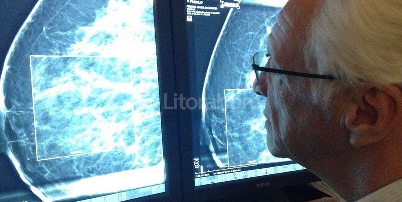 "Hay que detectar el cáncer de mama antes de llegar a palparlo"