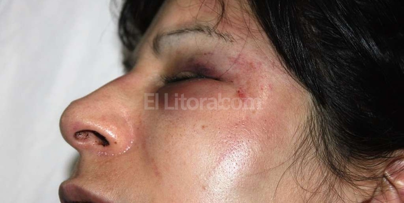 Una mujer sufrió una brutal golpiza por parte de su ex pareja