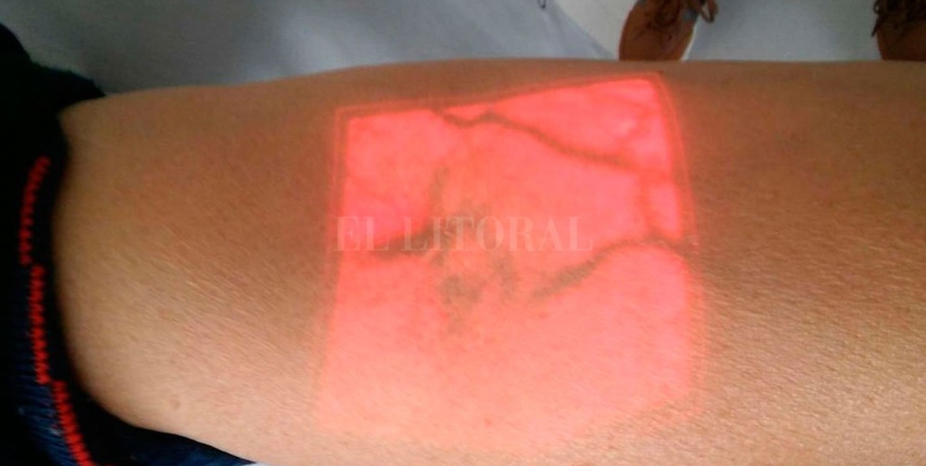 El Cemafe sumó un "visor" de venas para extracciones