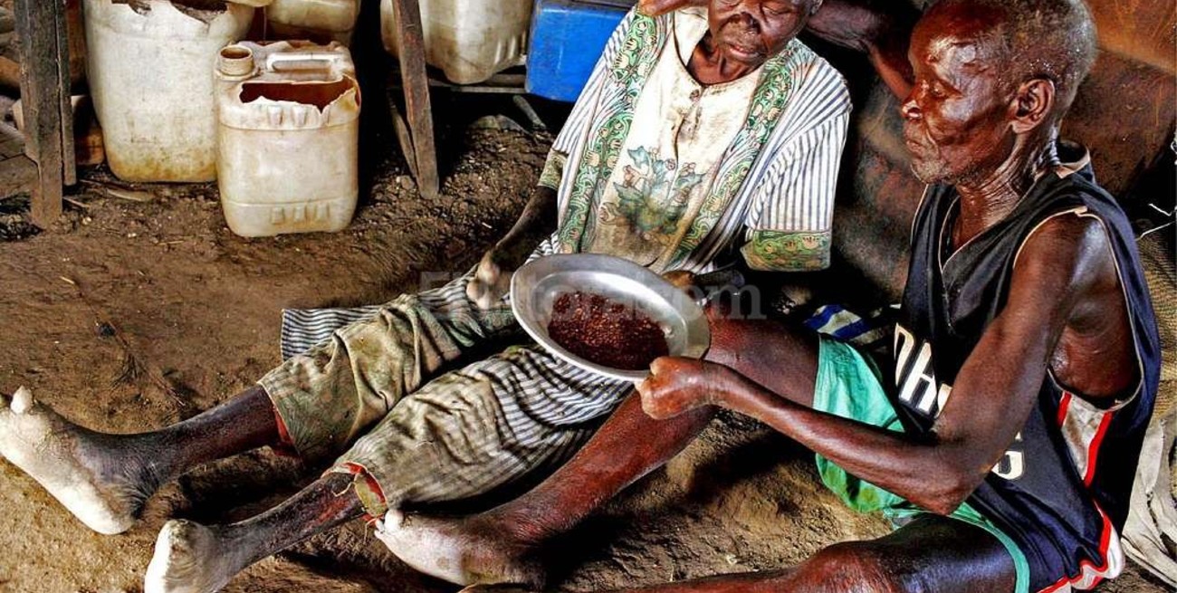 La lepra, enfermedad bíblica que aún subsiste