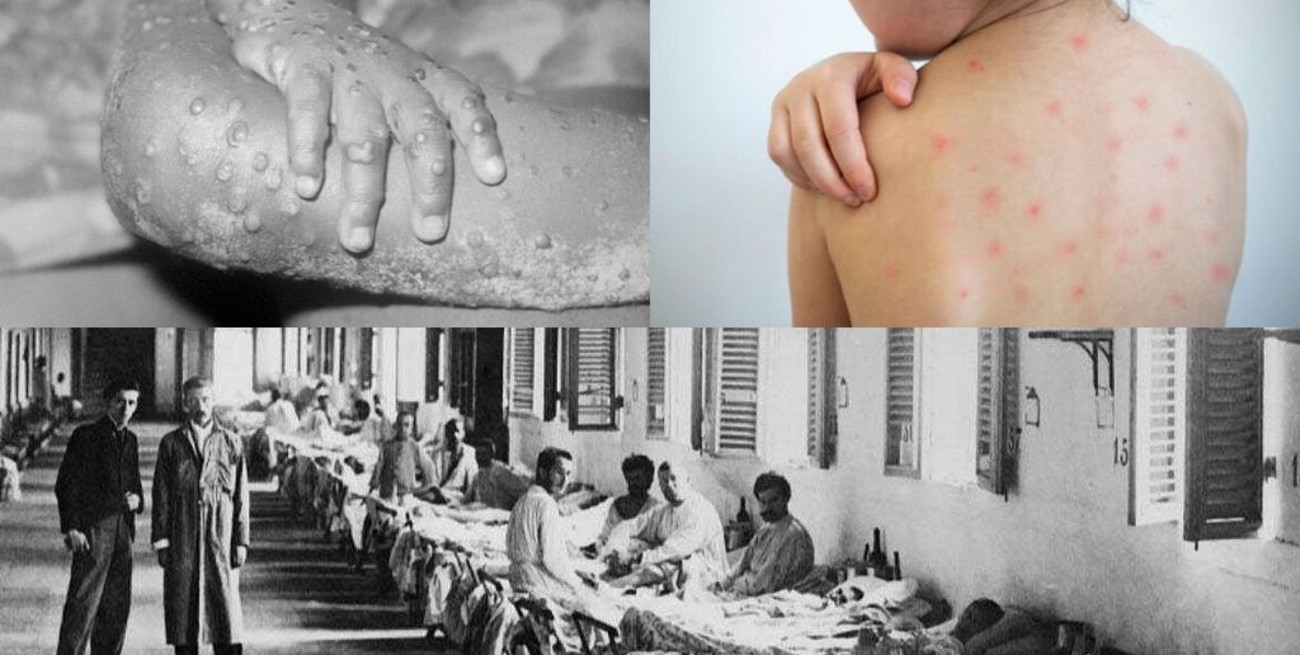 Grandes pandemias que sacudieron a la humanidad y desafiaron a la ciencia