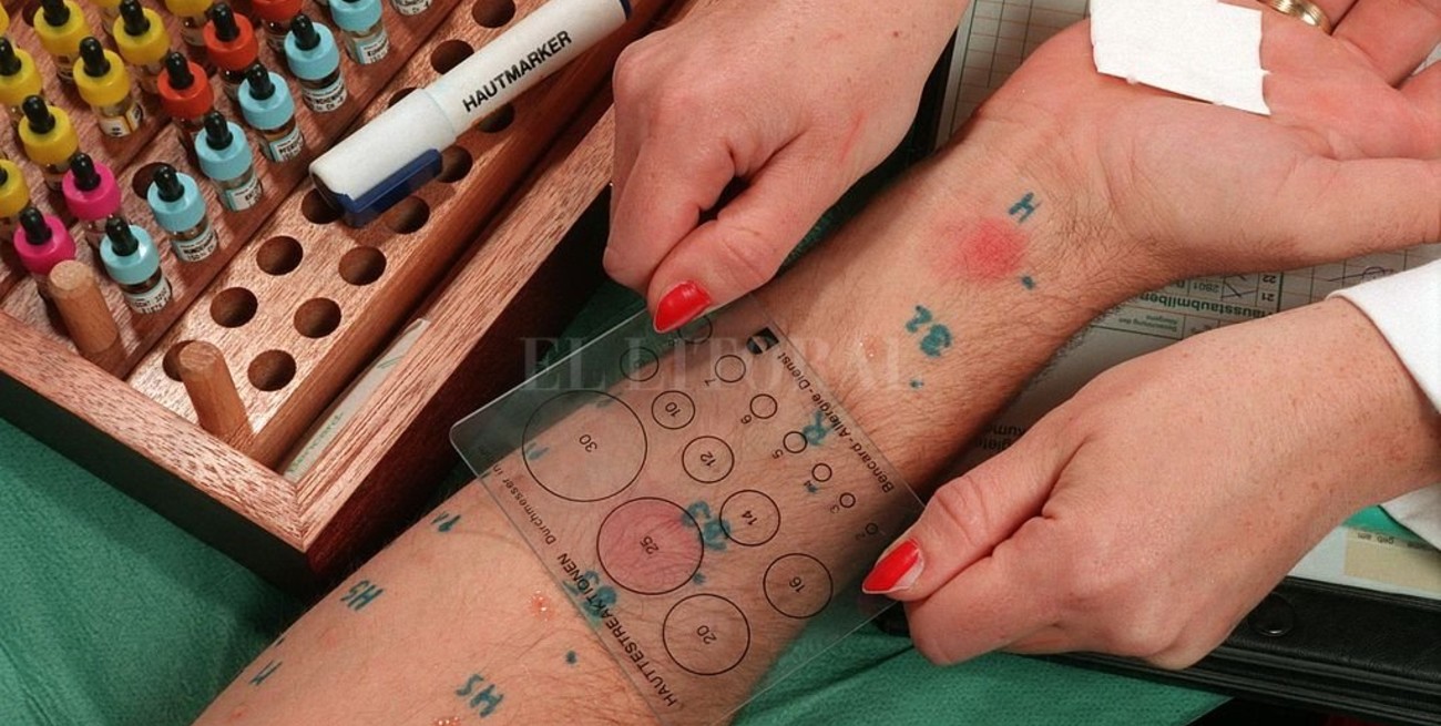 Las alergias se están transformando en una "emergencia mundial"