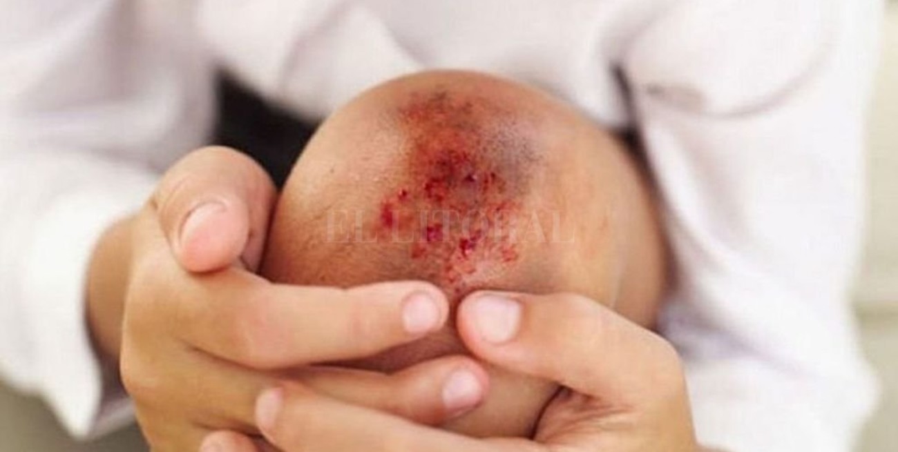 Hemofilia: una enfermedad "impopular", con pocos pacientes y tratamientos caros