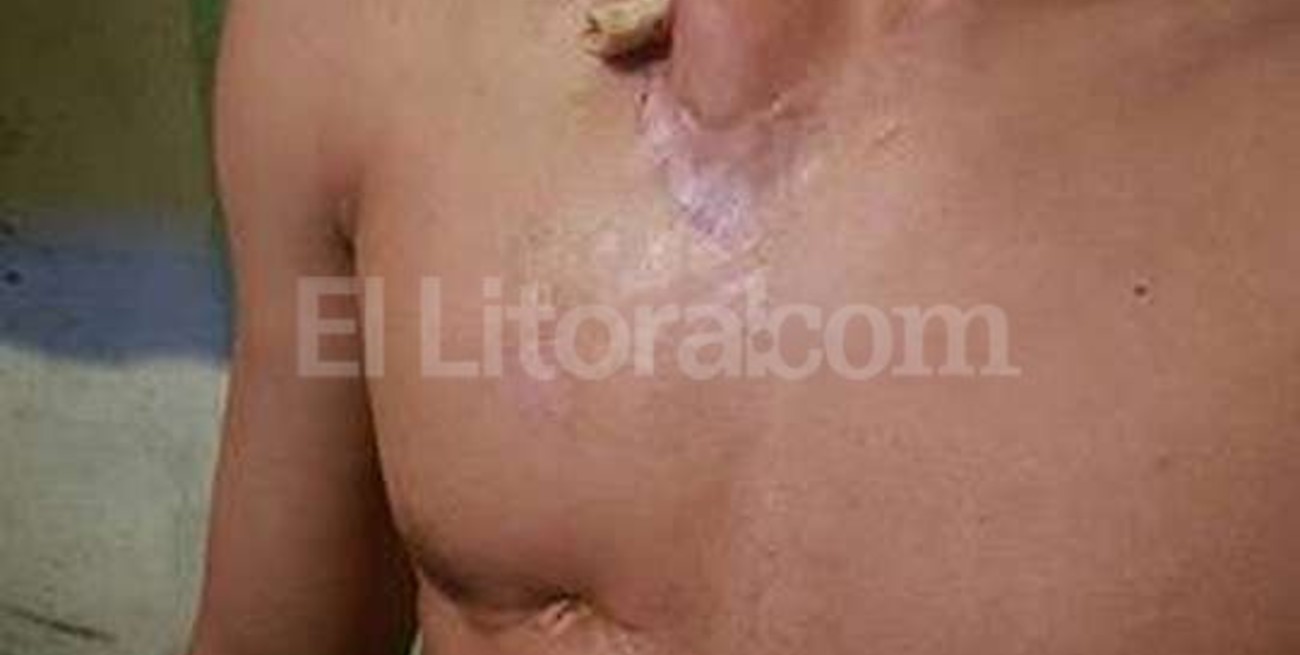 Un juez publicó una escalofriante foto de un preso en la cárcel de Batán