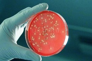 Gentileza Instituto Malbrán Los expertos del Malbrán continuarán los estudios para investigar si hay algún cambio genético en la bacteria, pero lo que detectaron hasta ahora es un  clon  que ya circulaba en el país.