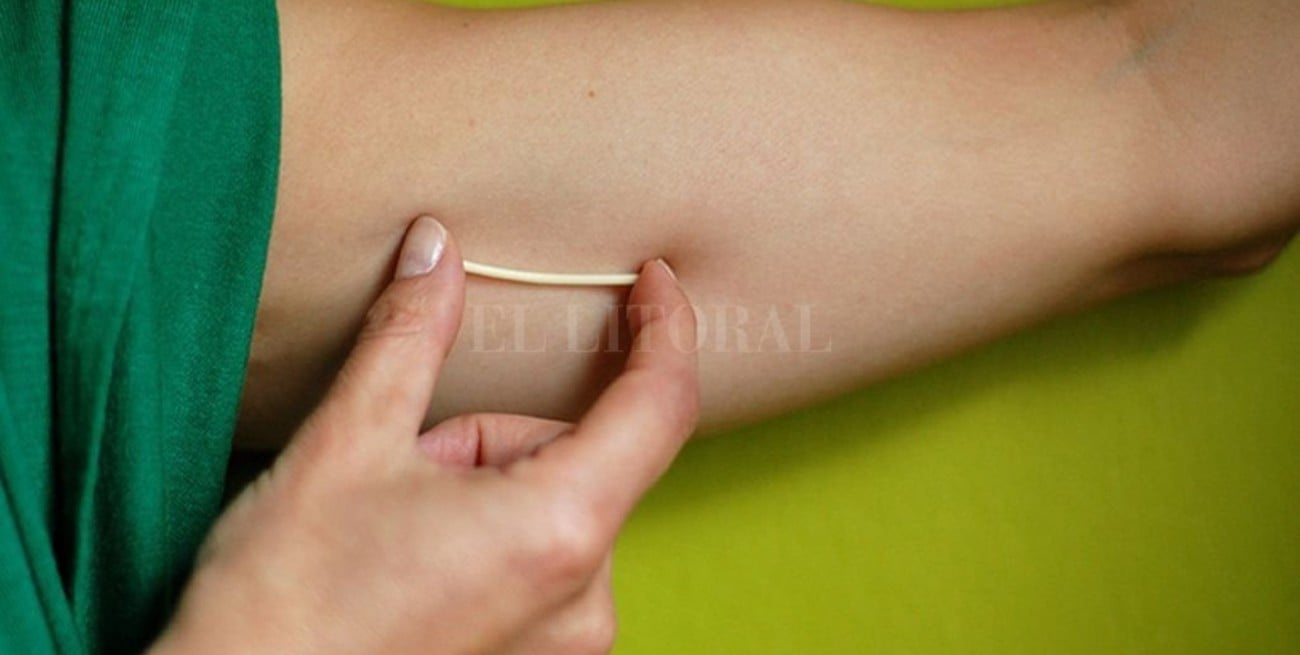 Solicitan garantizar implantes subdérmicos anticonceptivos