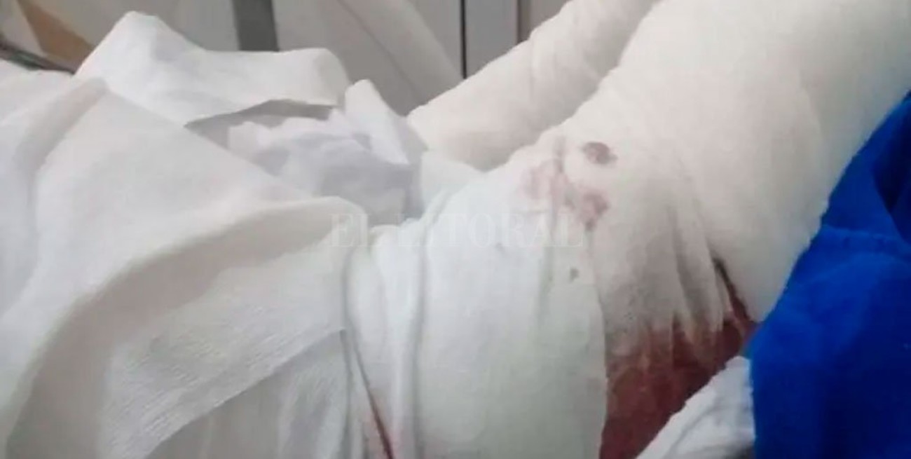 Permanece grave una mujer que fue atacada por tres perros en una playa en Mar del Plata