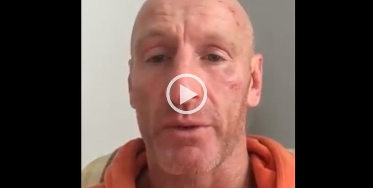 Golpearon brutalmente a una leyenda del rugby por ser gay